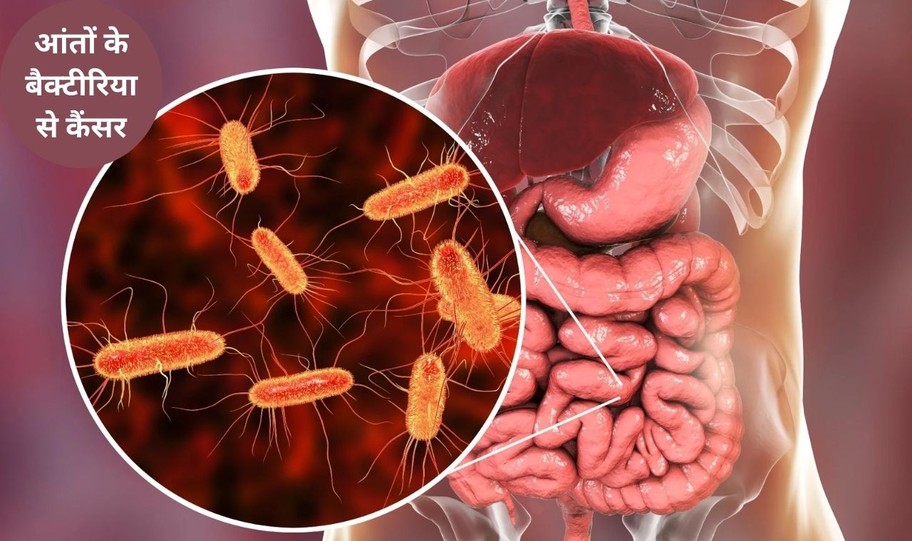 negative bacteria